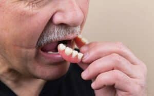 Remboursement Dentier Fixe : Une Solution Moderne et Durable