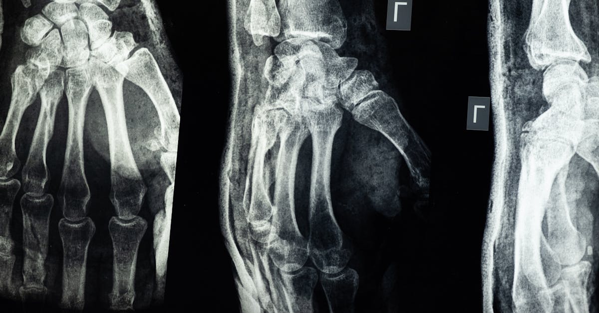 Type Radiologie Radiologie en 2026 : que couvre votre mutuelle santé ? 🏥💡